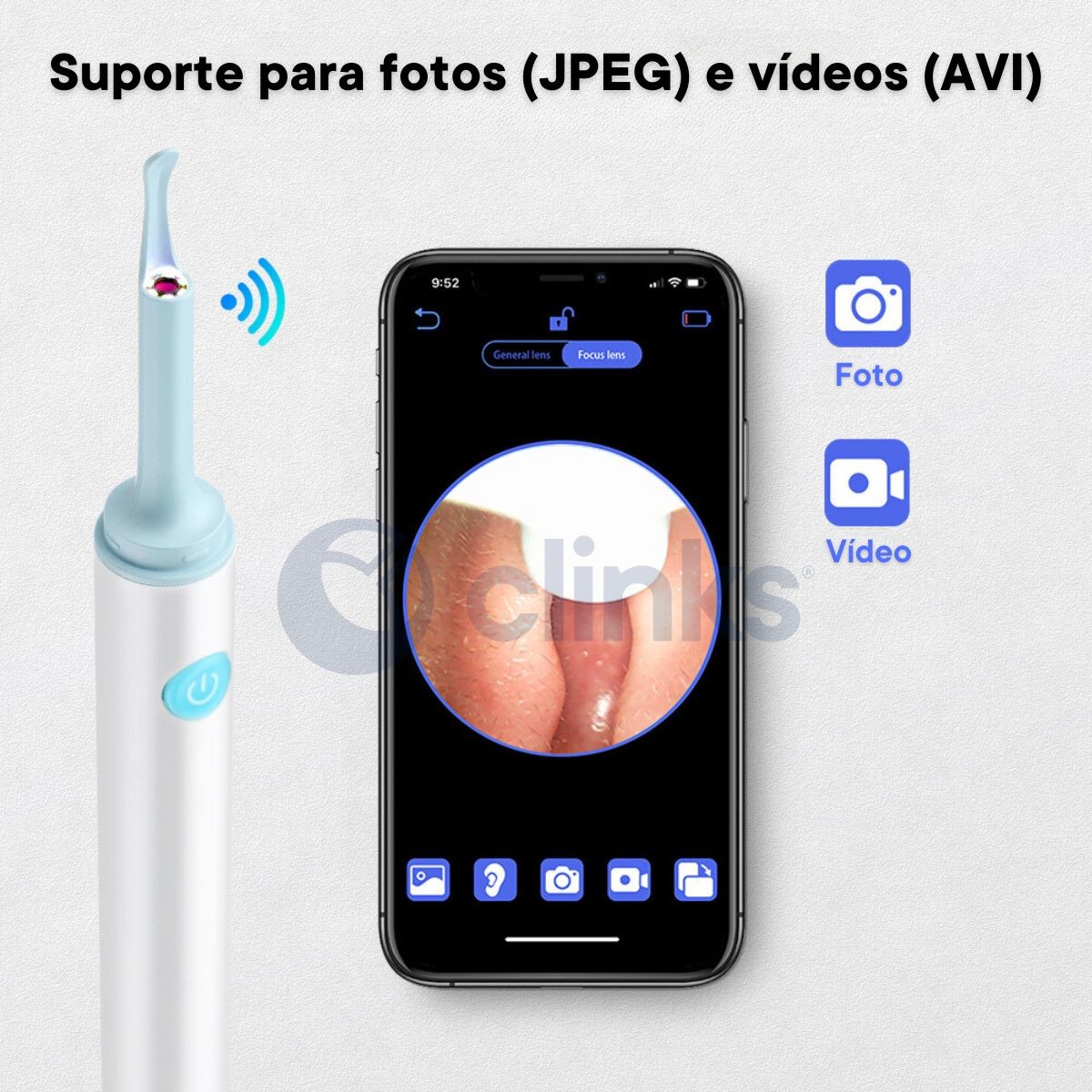 Otoscópio para Ouvido Sem Fios 6